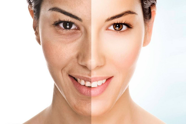 Skin Whitening Treatment in India: Types, Preparation & Aftercare